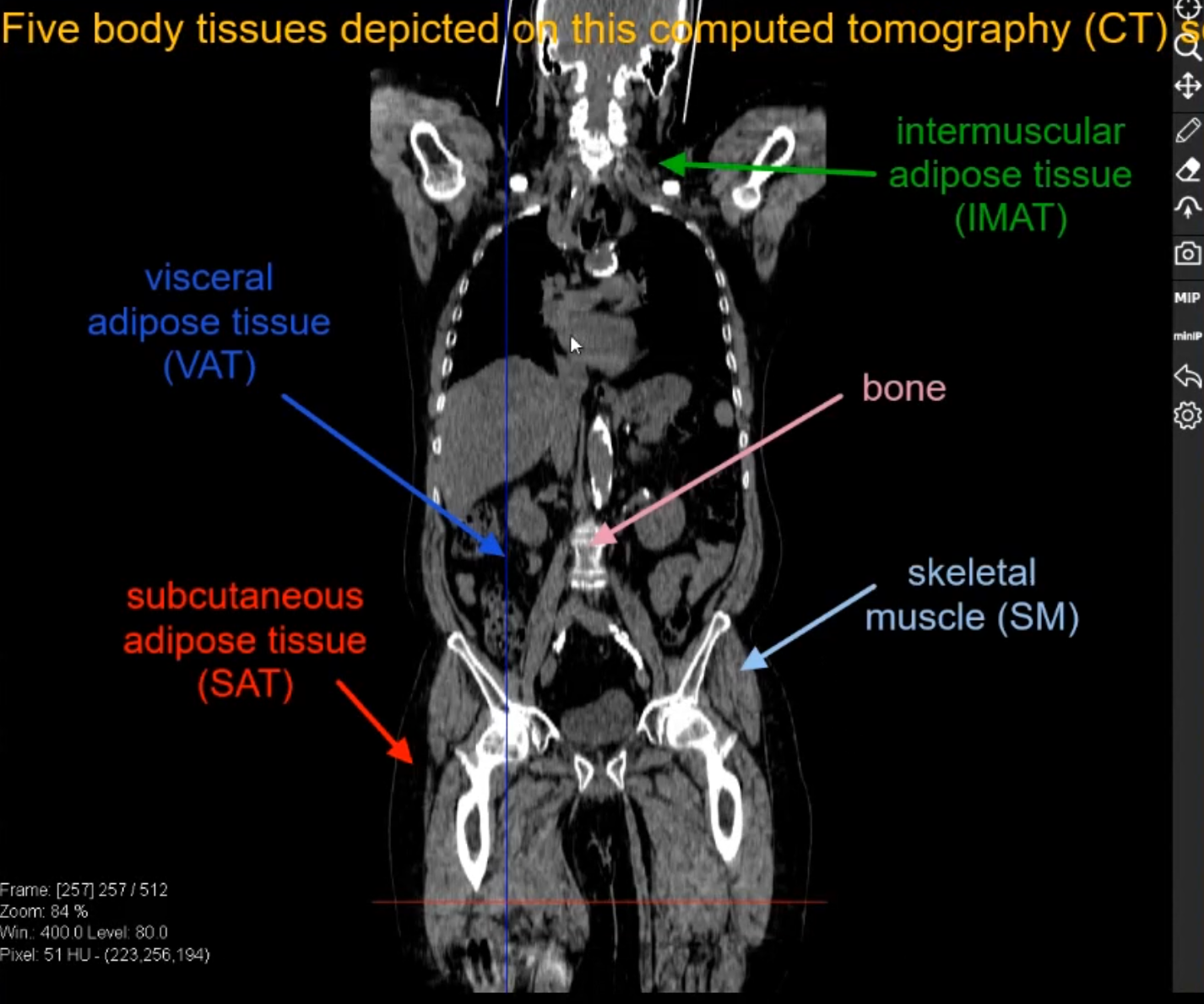 Body Composition