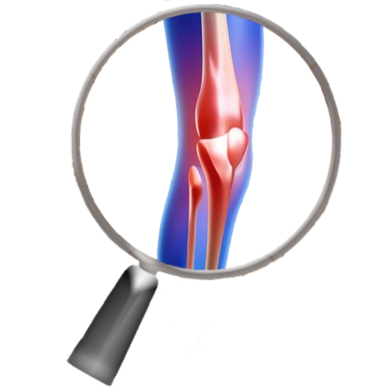 X-ray based Knee Patella Tracking