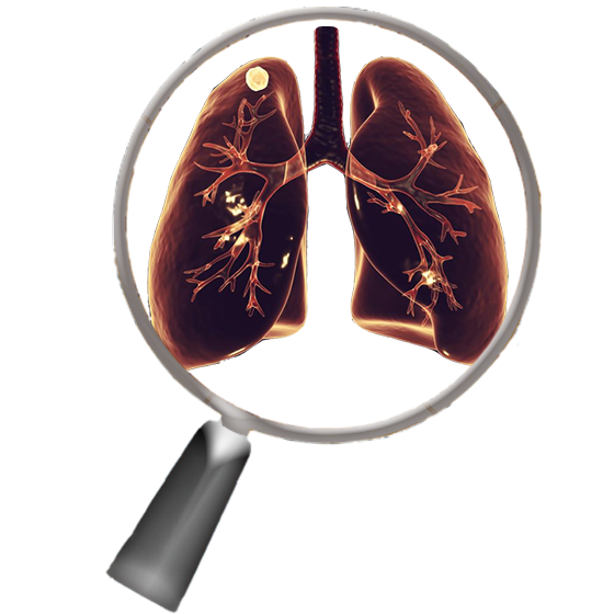 Automated nodule detection and malignancy assessment