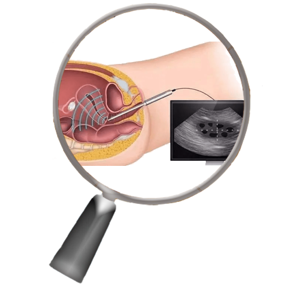 AI-based Quantification of Rectal Folding and Hypermobility based on Dynamic Ultrasound Imaging