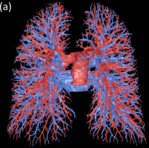 Lung Vessels (Arteries and Veins)