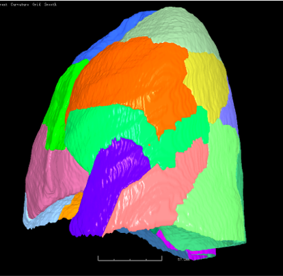 Lung Fissures, Lobes, and Segments